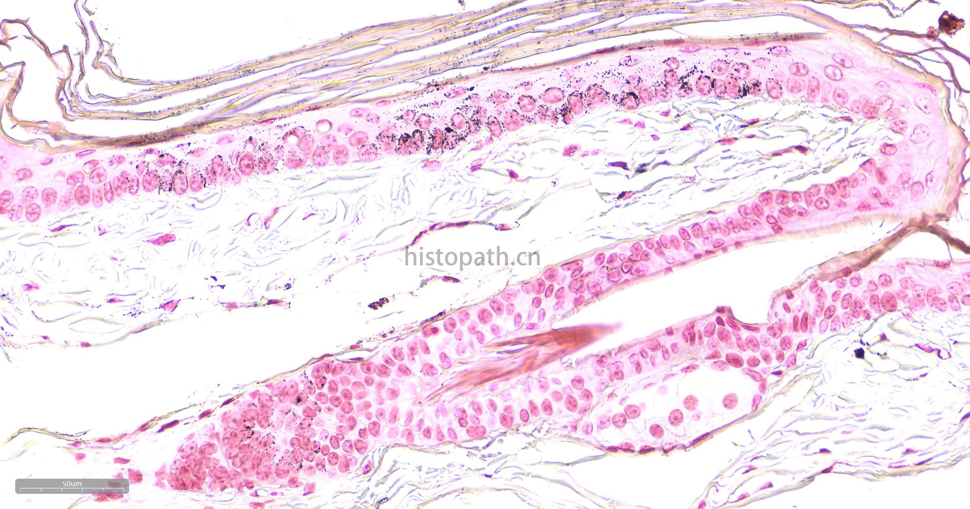 Masson-Fontana黑色素染色