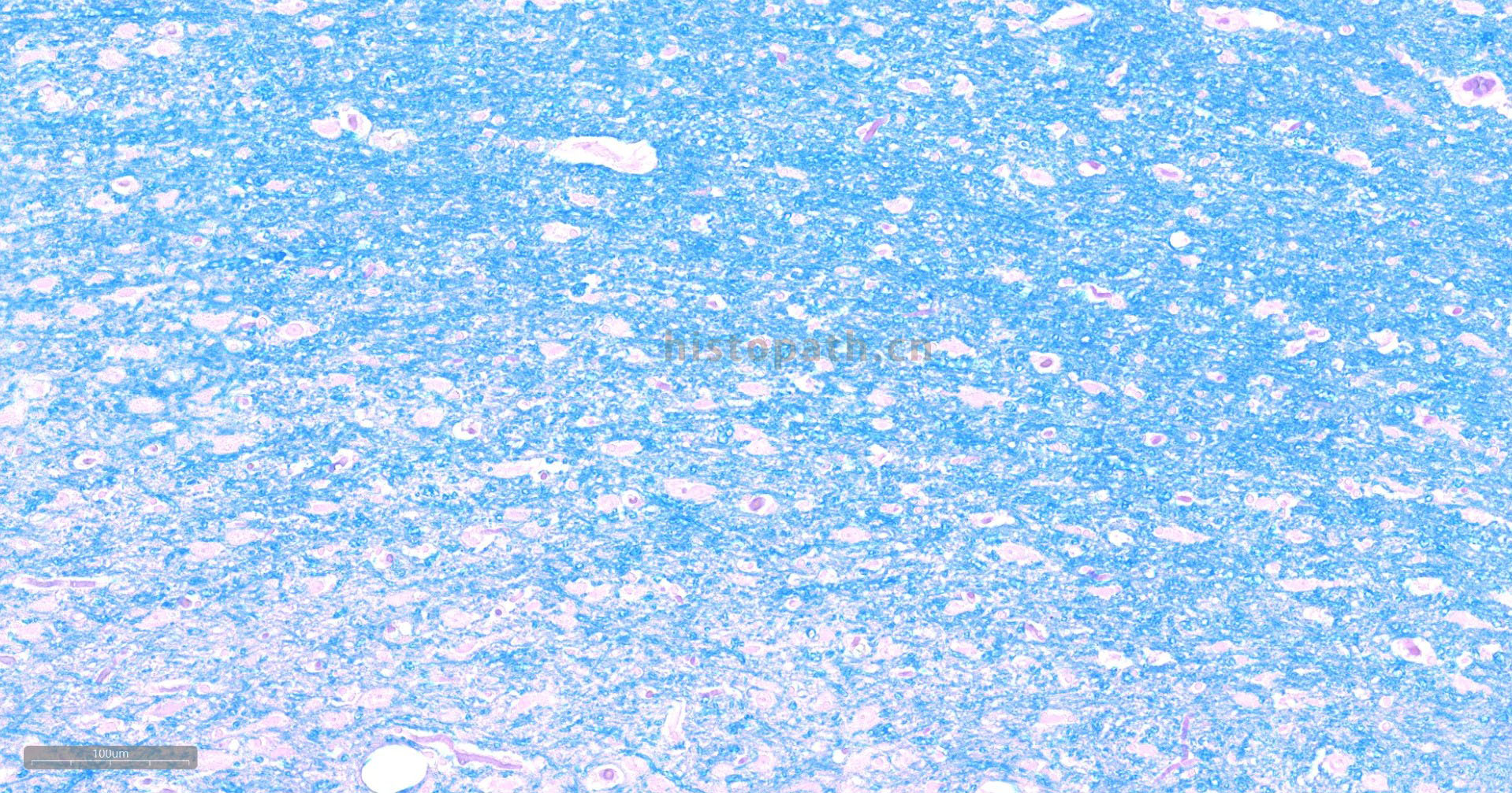 Luxol Fast Blue髓鞘染色